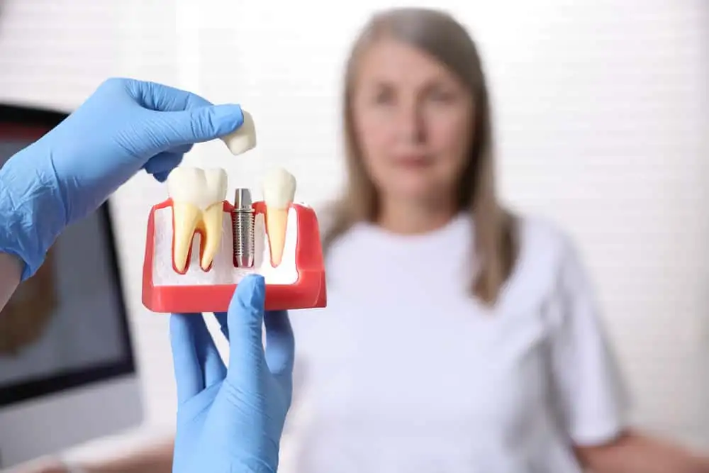 Dental implants vs dental bridges for missing teeth in Queens